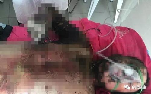 如皋医院爆料烧伤视频,惨烈现场令人揪心